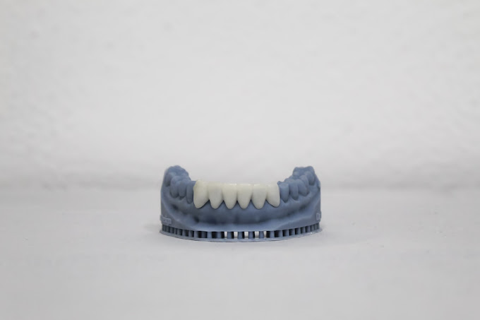 Protese dentaria impressa em 3D
